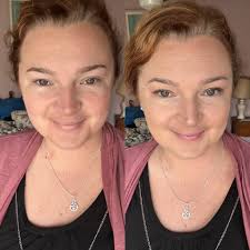 Makeup for redness and self-confidence boost