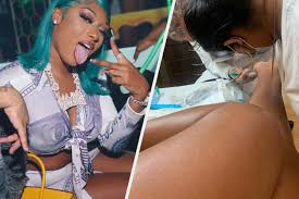 Megan Thee Stallion Posted A Photo Of Her Gunshot Wound