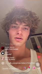 Tyler Stanton Hair Removal