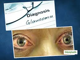 Oct 23, 2020 · glaucoma treatment often starts with prescription eyedrops. What Is Glaucoma Here Are Its Symptoms Causes And Treatment