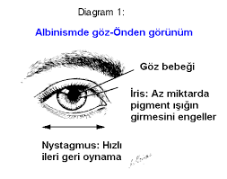 Albinizm Bilgileri Ali Sengoz