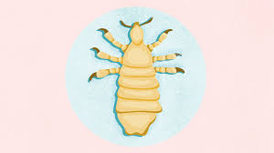 Image result for Lice
