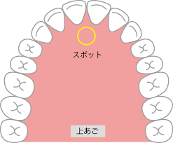 舌癖とは？正しい舌の位置と舌癖を治す方法 | 博多矯正歯科 KITTE博多院