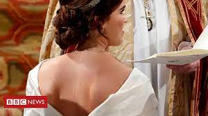 Maybe you would like to learn more about one of these? Casamento Real Por Que A Princesa Eugenie Escolheu Um Vestido Que Deixava Sua Cicatriz A Mostra Bbc News Brasil