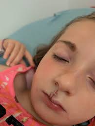 Dogs preferring cold surfaces or being covered with blankets