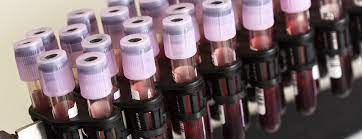 Faq Cell Free Dna Screening Patient Education Ucsf Health