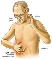 Gallbladder Disease Bile Duct Cancer Top Nursing Schools Medical Training
