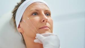 How Long Do Silhouette Threads Last?