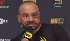 Unrecognizable Eddie Alvarez makes 'love' admission after suffering brutal  MMA injury