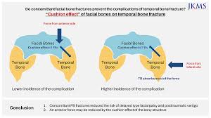 Image result for Fracture Complication