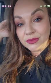 Age Spots and Self-Acceptance