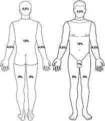 Management Of Major Burns On The Intensive Care Unit