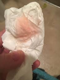 Maybe you would like to learn more about one of these? Can You Bleed Before A Miscarriage