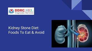 Kidney Stone Diet Foods To Eat Avoid Kidney Stone Diet Kidney Stones Kidney