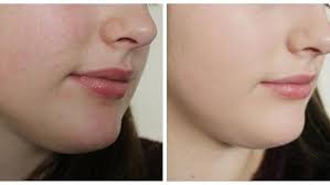 Ciraldo says if you're naturally very dry, this gentle exfoliating acid is the. How To Get Smooth Skin On Face Kfoods Com