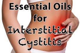 Some Useful Essential Oils For Interstitial Cystitis Are Sandalwood Juniper Cypress Sage And Lavender Ess Interstitial Cystitis Cystitis Best Essential Oils