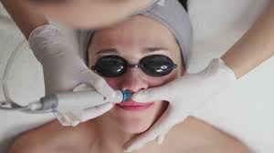 عمرى ما بنصح بجلسات الفشيال و التنضيف دى ابدا , الا فى حالات معينه !!!!! ,  تعالى نتكلم ايه الحالات اللى محتاجه فعلا تعمل فشيال ومين اللى مش صح ابدا  يعمل الا تحط ظروف معينه , اول حاجه الحالات اللى فعلا ...