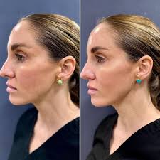 𝗝𝘂𝗹𝗶𝗲 𝗕𝗼𝗿𝗲𝗻 𝗦𝗰𝗵𝗺𝗶𝗱𝘁