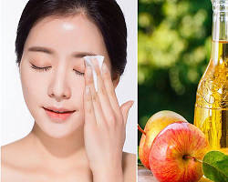 Hình ảnh về Táo cho da