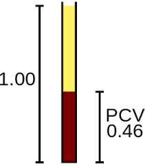 La brizzi distribuzione nasce a roma nel 1974. Emocromo Wikiwand