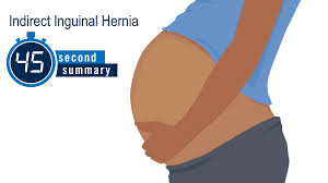 Image result for Inguinal hernia child