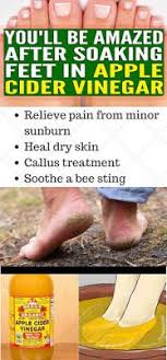 Apple cider vinegar also cures cracked heels with perfection. Pin On Beauty And Style