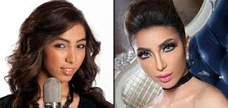 (لا يجوزُ إجراءُ جِراحةِ التَّجميلِ التَّحسينيَّةِ التي لا تدخُلُ في العِلاجِ الطِّبيِّ، ويُقصَدُ منها تغييرُ خِلقةِ الإنسانِ السَّوِيَّة تبعًا للهوى والرَّغَباتِ بالتقليدِ للآخَرينَ، مثل عمليَّات تغييرِ شَكلِ الوَجهِ للظُّهورِ بمَظهرٍ مُعَيَّنٍ. Ø¨Ø§Ù„ÙÙŠØ¯ÙŠÙˆ Ø¯Ù†ÙŠØ§ Ø¨Ø·Ù…Ø© ØªØ¹ØªØ±Ù Ø£Ø¬Ø±ÙŠØª Ø¹Ù…Ù„ÙŠØ§Øª ØªØ¬Ù…ÙŠÙ„ Ø®Ø¨Ø± ÙÙŠ Ø§Ù„ÙÙ†