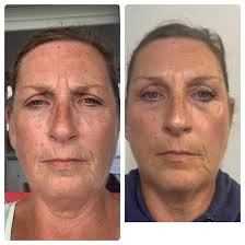 Riman skincare line review and recommendations