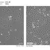 The question about whether thawing cells represents a passage or not is one that is asked frequently. 3