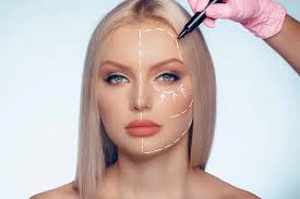 جراحة التجميل في أبوظبي | جراح تجميل، الجراحة الترميمية، طبيب تجميل الأنف