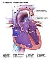 Blue Baby Syndrome Wikipedia