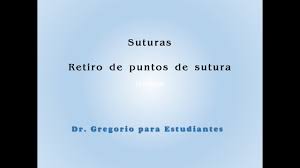 Retiro De Puntos De Sutura Youtube