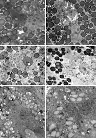 Maybe you would like to learn more about one of these? A Comparative Ultrastructure Study Of Storage Cells In The Eutardigrade Richtersius Coronifer In The Hydrated State And After Desiccation And Heating Stress