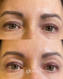 Glo MD Aesthetics and Wellness