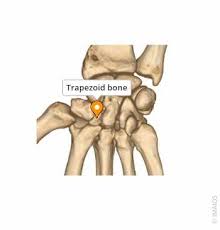 Image result for Trapezoid Bone