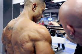 Rear Delt And Lat Striation Bodybuilding Anabolic Steroid Androgen Receptor
