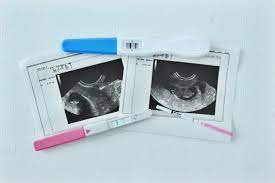 Unfruchtbarkeit bei mann und frau. Eisprung Bestimmen Fruchtbare Tage Mit Ovulationstest Erkennen