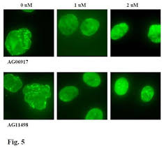 I think these proteins linked to progeria play a very profound role in the aging. Kids With Rare Rapid Aging Disease Get Hope From Study Drug