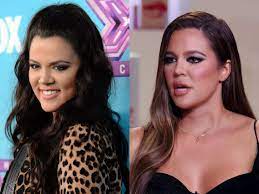 Khloé looked suuuper different in keeping up with the . Khloe Kardashian Confirms She S Had One Nose Job And Injections