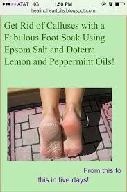 New style electric foot callus remover pedicure device exfoliating scrub to calluses grind crural stone usb rechargeable grindin. End Unwanted Foot Calluses Epsom Salt Lemon And Peppermint Oils Essential Oils Oils Exfoliating Lip Scrub