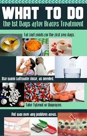 Pin By Kaden Roberson On Braces After Braces Braces Treatment Braces Tips
