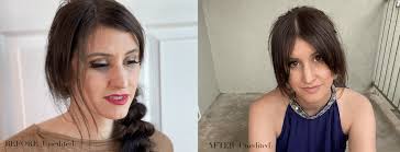 Check spelling or type a new query. How To Get Rid Of 11 Lines Without Botox The Vanilla Plum