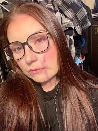 Fundraiser by Amy Gibson : Support Amy Nicole's Medical Recovery