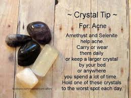 For Acne Crystals Crystal Healing Stones Gemstone Healing