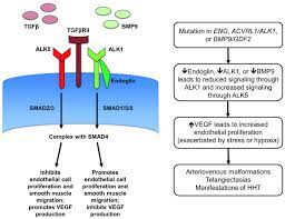 Hereditary Hemorrhagic Telangiectasia Diagnosis And Management From The Hematologist S Perspective Haematologica