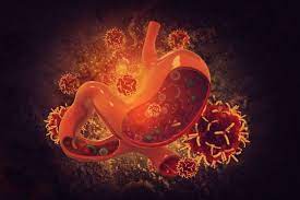 A tumor in the stomach will often lead to improper breakdown of food in the stomach, which, in turn, can lead to burping and other symptoms of indigestion. Do You Have Stomach Cancer Are You Scared That You Might Here Is What You Need To Know Rai Health Awareness Blog