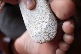 How To Remove A Seed Corn On The Foot Corn Seed Corn On Toe Corn Removal