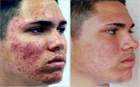 Mathew — VILLANI MEDICAL