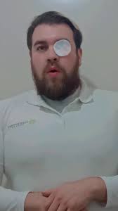 Ya no me la hagas jochis 🙈😢🥴 #urzuelomaldeojo #urzuelo #perrilla  #perrillasenlosojos #ojo #humor #comedia #parodia #cunadelobos  #catalinacreel #novelas #novela