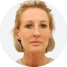 Sculptra for Sagging Skin & Volume Loss